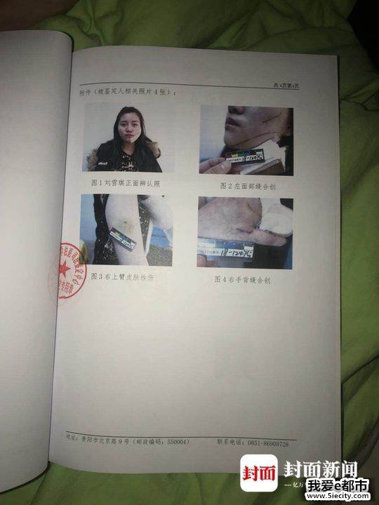 ŮŮص ӦΪ΢